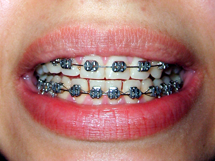 images/ortodonta.jpg148d3.jpg